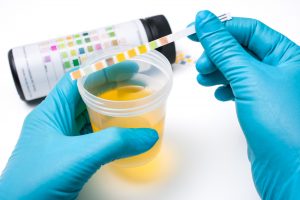 SER adviseert SZW over biomonitoring en sensoring