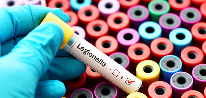 HSE-Actueel-legionella